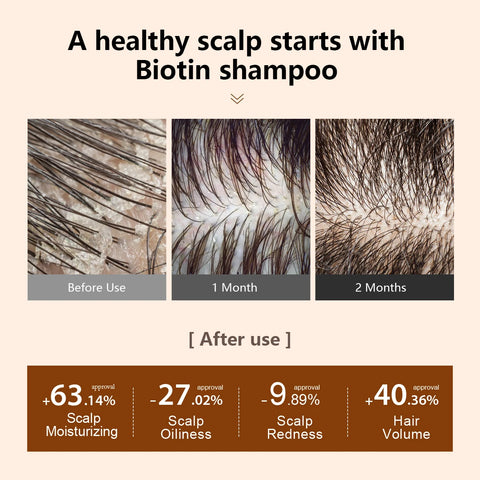 Biotin Prevent Hair Loss Shampoo And Conditioner Growth Oil Treatment For Hair Fast Regrowth Care Beard Hair Beauty Health Care