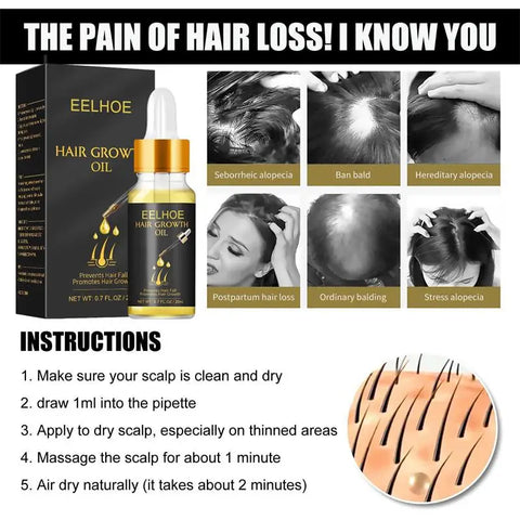 Fast Hair Growth Serum Hair Regrowth Essential Oil Anti Hair loss Repair Damaged Scalp Women Men Anti Baldness Hair Growth Care