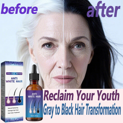 Gray to Black Hair Transformation Promote growth Anti white hair serum Reverses Graying Nourishes Scalp & Follicles