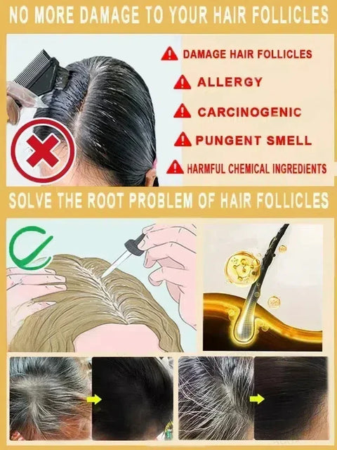 Gray to Black Hair Transformation Promote growth Anti white hair serum Reverses Graying Nourishes Scalp & Follicles