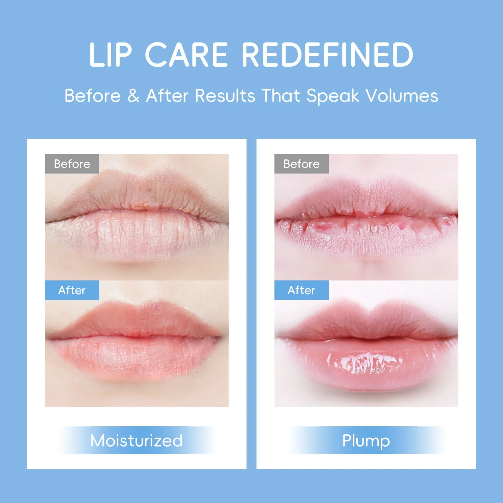 Laikou Milk Lip Mask Hydrating Repair Remove Lines Blemishes Lighten Lip Line Collagen Gel  Lips Pad Patches Skin Care Product