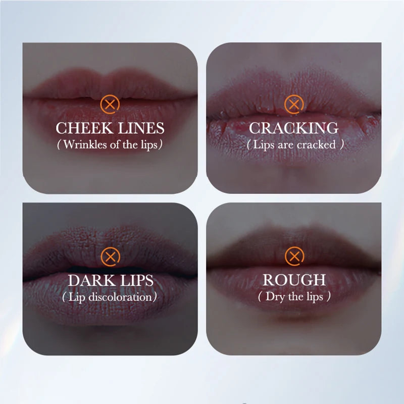 10pcs SADOER Snail Crystal Collagen Lip Mask Anti Wrinkle Nourishing Plump Lips Moisturizing Lip Patches Skin Care