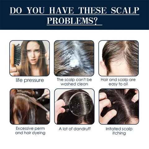 Hair Growth Products Fast Growing Hair Serum Spray Anti Hair Loss Treatment Essential Oil Repair Nourish Root For Men Women