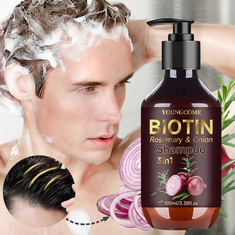Shampoo Gently Clean Hair Biotin Rosemary Onion Shampoo Remove Dandruff Control Oil Reduce Hair Loss Stabilize Hair Roots Nouris