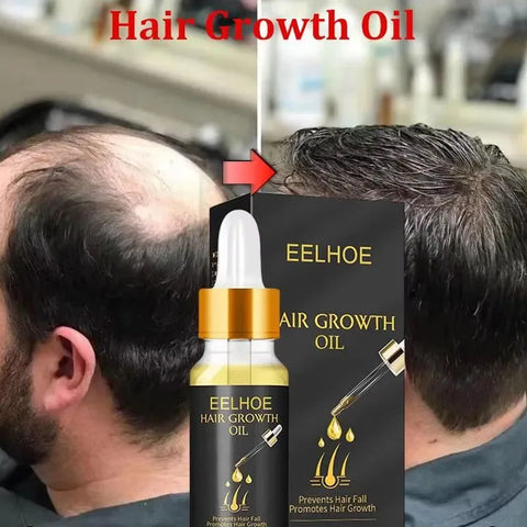 Fast Hair Growth Serum Hair Regrowth Essential Oil Anti Hair loss Repair Damaged Scalp Women Men Anti Baldness Hair Growth Care