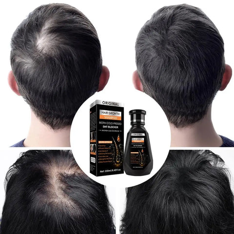 250ML Biotin Shampoo For Hair Growth And Thinning Hair – Ginger Shampoo Thickening Formula For Hair Loss Treatment For Women Men