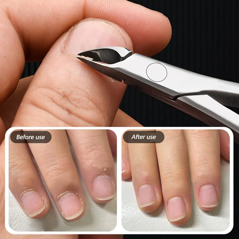Stainless Steel Cuticle Trimmer Nail Nipper Cuticle Remover for Nail Products Toenails Dead Skin Professional Pedicure Tools