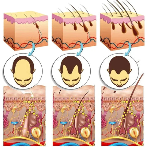 7 Days Ginger Hair Growth Serum Fast Promote Hair Regrowth Products Anti Hair Loss Repair Scalp Baldness Nourish Hair Root Care