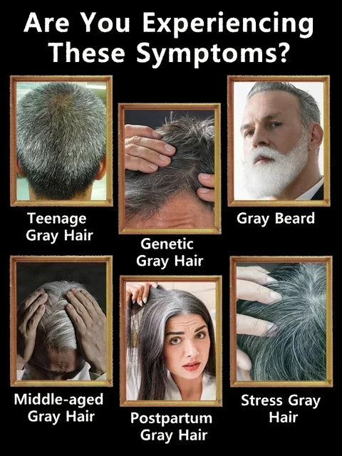 Gray to Black Hair Transformation Promote growth Anti white hair serum Reverses Graying Nourishes Scalp & Follicles