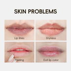 KORMESIC 24K Golden Crystal Collagen Lip Mask Moisturizing Plump Lips Gel Masks Nourishing Hydrating Lip Plumper Lips Skin Care