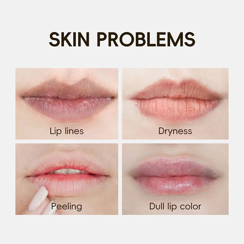 KORMESIC 24K Golden Crystal Collagen Lip Mask Moisturizing Plump Lips Gel Masks Nourishing Hydrating Lip Plumper Lips Skin Care