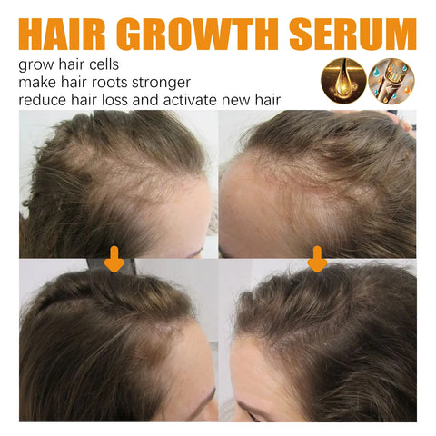 Biotin Hair Growth Serum Spray Nourishing Hair Follicles Refreshing Oil Controlling Reducing Hair Loss Hair Care Hair Spray