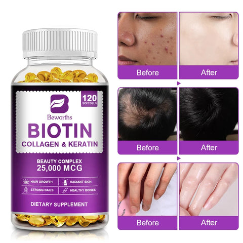 BEWORTHS Collagen and Biotin Capsules Biotin for Hair Growth Healthy Nails &Skin Hair Farming Supplement Beauty Health Skin Care