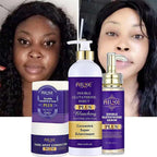 AILKE Premium Skin Lightening Cream - Dark Spot Corrector for Uneven Skin Tone - Face, Body, Underarm, Knees, Elbows, Knuckle