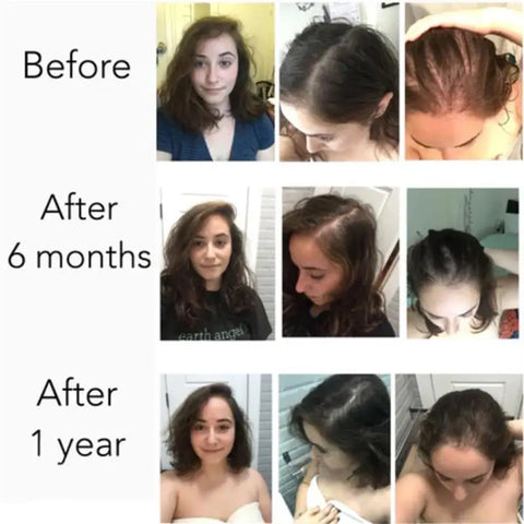 Fast Hair Growth Serum Hair Regrowth Essential Oil Anti Hair loss Repair Damaged Scalp Women Men Anti Baldness Hair Growth Care