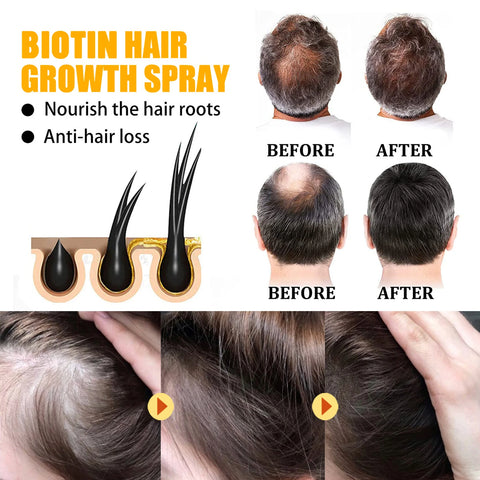 Biotin Hair Growth Serum Spray Nourishing Hair Follicles Refreshing Oil Controlling Reducing Hair Loss Hair Care Hair Spray