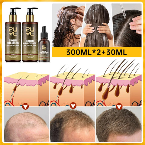 Biotin Prevent Hair Loss Shampoo And Conditioner Growth Oil Treatment For Hair Fast Regrowth Care Beard Hair Beauty Health Care