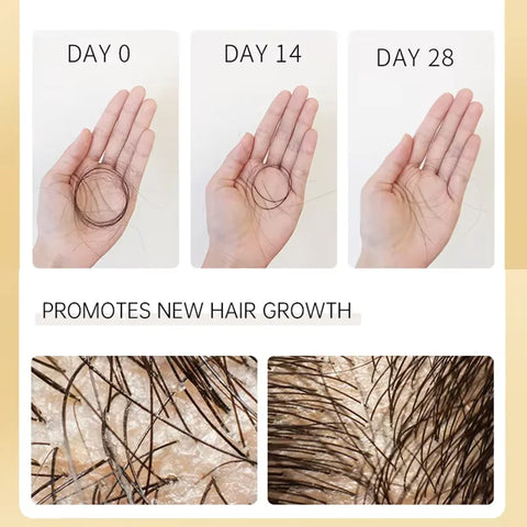 Biotin Prevent Hair Loss Shampoo And Conditioner Growth Oil Treatment For Hair Fast Regrowth Care Beard Hair Beauty Health Care