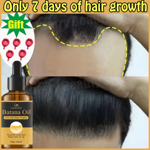 7 Days Fast Batana Oil Hair Growth Serum Anti-loss Hair Regrowth Products Repair Damaged Hair Roots Hair Care For Women Men