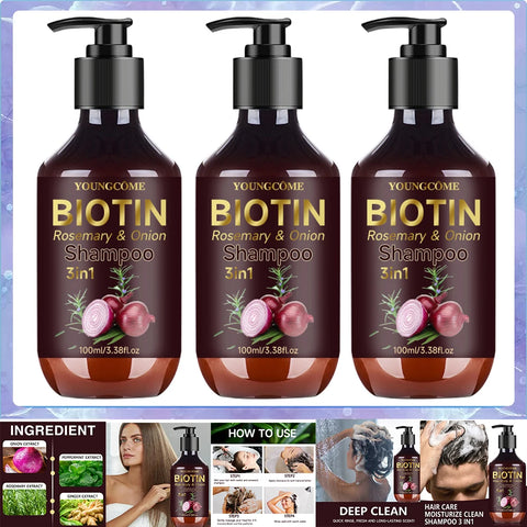 Shampoo Gently Clean Hair Biotin Rosemary Onion Shampoo Remove Dandruff Control Oil Reduce Hair Loss Stabilize Hair Roots Nouris