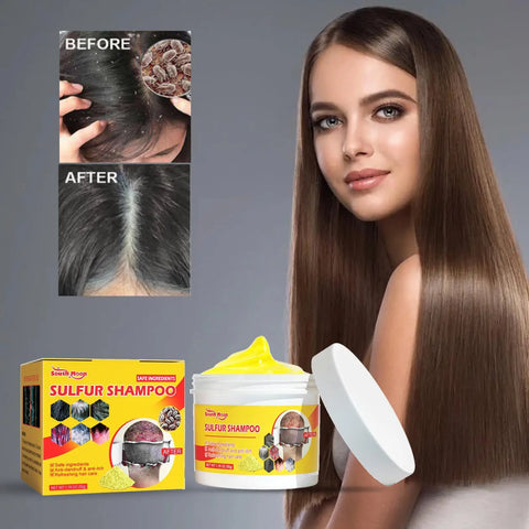 50g Sulfur Shampoo Remove Lice Mites Dandruff Itching Oil Cleaning Scalp Deep Hair Antipruritic Follicles Cleaning Hair Care