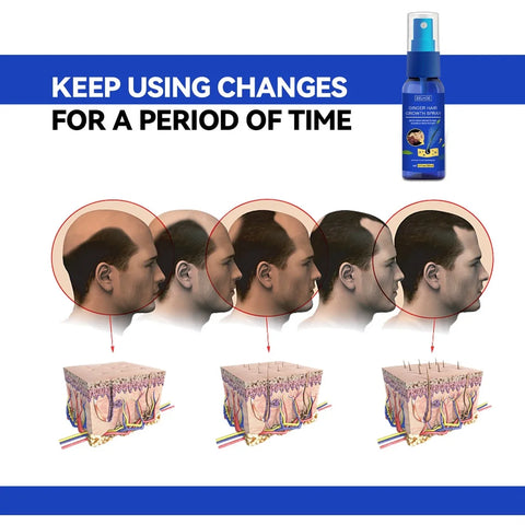 Ginger Hair Growth spray Anti Hair Fall Hair Loss Treatment Growth Essence Oil for Men Women