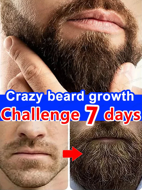 The most effective beard growth essence in 2025, grow a thick beard in 7 days. Chest hair, leg hair, beard and hair growth