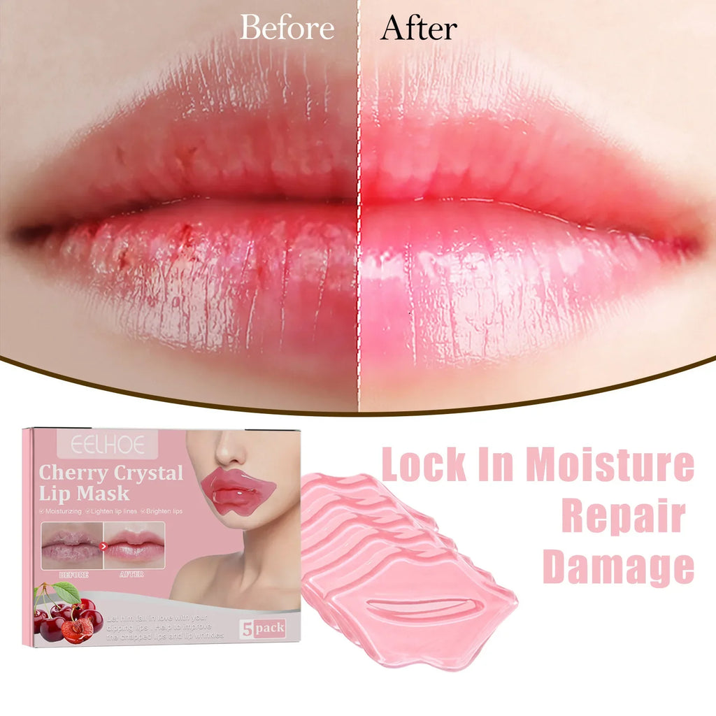 EELHOE Cherry Nourishing Lip Mask Fade Lip Lines Improve Dry Repair Cracks Smoothing Lip Patches Moisturizing Skincare Mask 5pcs