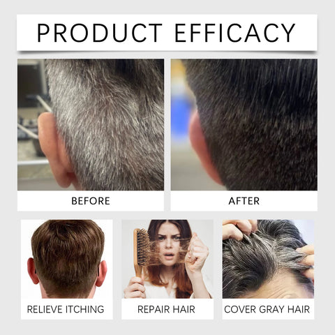 Hair Care Serum Grey hair Serum White Hairs Essence Anti-gray Hair Improve Hair Color Care Soft Black Daily Hair Care 30ML