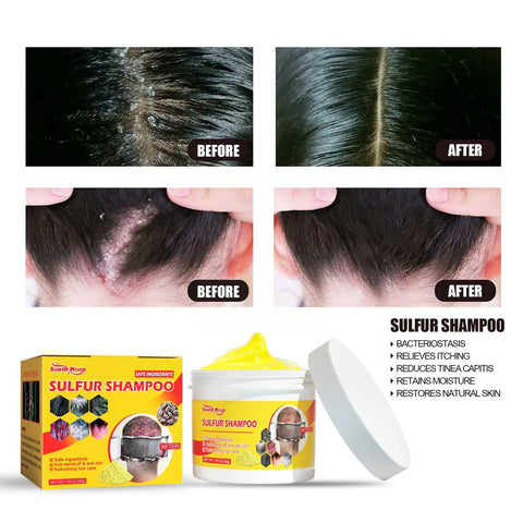 50g Sulfur Shampoo Remove Lice Mites Dandruff Itching Oil Cleaning Scalp Deep Hair Antipruritic Follicles Cleaning Hair Care